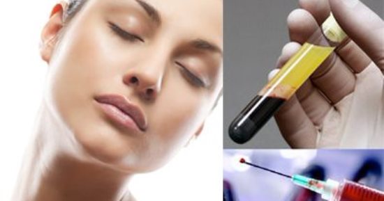 خليكى فى الطبيعى.. عالجى بشرتك وشعرك بتقنية الحقن بالصفائح الدموية PRP