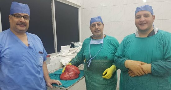 صور .. استئصال ورم خبيث يزن 10 كيلو من كلية مريض بمركز أورام طنطا
