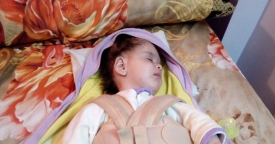 "فريدة" آخر ضحايا الضمور الشوكى.. ووالدتها تناشد المسئولين إنقاذها