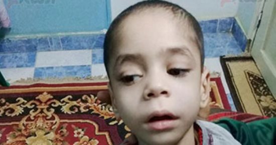 صور.. مأساة الطفل عمرو بالوادى الجديد.. أصيب بـ"سخونية" أدت لتوقف نموه