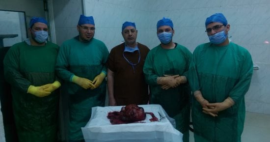 استئصال ورم وزنه 12 كيلو من معدة فتاة بمعهد أورام طنطا