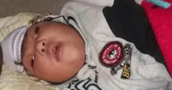 أب يستغيث: "ابنى عنده كيس ميه على راسه ومحتاج عملية والأطباء بيأجلوا"