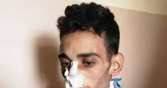 صور.. مأساة شاب بالمنوفية يعانى من السرطان ويناشد وزير الصحة لعلاجه