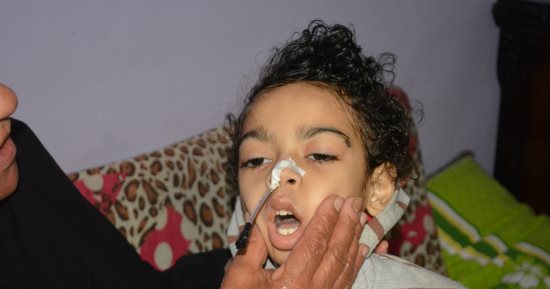صور.. "جوشر" مرض ينهش جسد الطفل محمد ووالده ينتظر رد وزارة الصحة