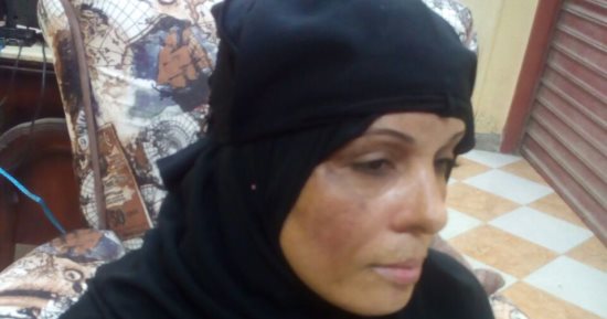 صور..مأساة ربة منزل بالشرقية ضحية انفجار أنبوبة: "نفسى اتعالج وانا غلبانة"