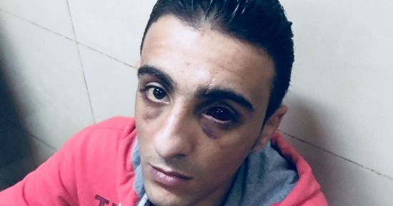 أحمد كان عاوز يحسن دخله بتوصيل المواطنين بسيارته فتعرض للسرقة ومحاولة قتل