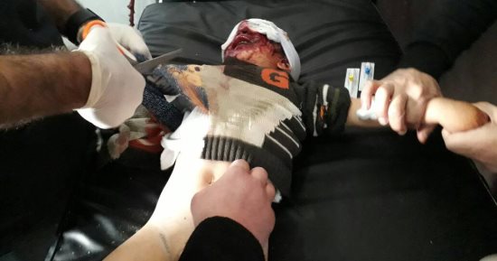 صور..جيش أردوغان يرتكب مجزرة جديدة بحق المدنيين فى عفرين