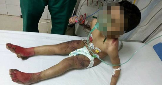 القبض على ربة منزل عذبت طفلها وحرقت جسده بمساعدة زوجها فى كفر الشيخ