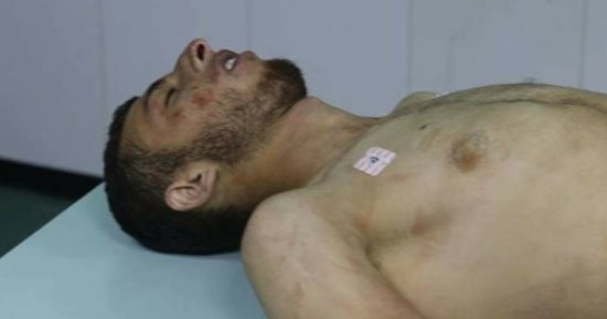 صور.. شهيد ومصاب برصاص الاحتلال الإسرائيلى فى نابلس