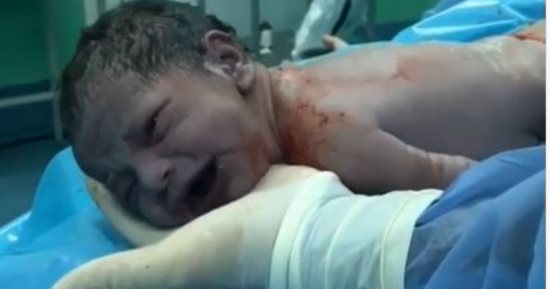 ملكة جمال سوريا تنشر فيديو ولادة قيصيرية على إنستجرام