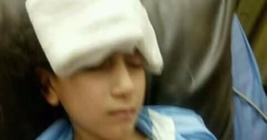 تفاصيل إصابة طفلة بطلق نارى مجهول أثناء تواجدها بمحل بقالة بمنشأة ناصر