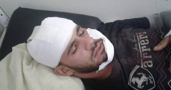 جهود لضبط مسجلين شوها وجه شاب لمحاولته فض مشاجرة بينهما بكفر صقر بالشرقية