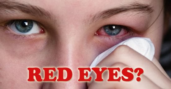 ماذا تفعل عند التعرض لإصابة أو حادث فى العين؟.. وزارة الصحة توضح