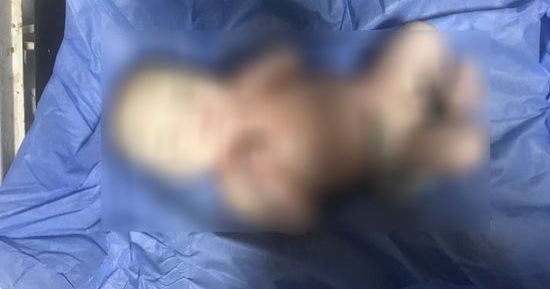 حالة نادرة.. سيدة فى الفيوم تضع "طفل شمعى" بالمستشفى العام