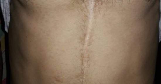 مأساة رب أسرة بالبحيرة يعيش بقلب مريض ويحلم بامتلاك توك توك للعمل عليه