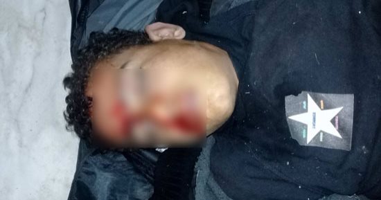 مصرع طالب صدمته سيارة مسرعة أثناء عبوره الطريق فى الدقهلية