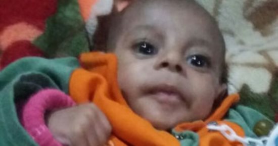 صور .. طفل دخل المستشفى لإجراء جراحة فتاق فأجريت له 4 جراحات بـ40 يوما