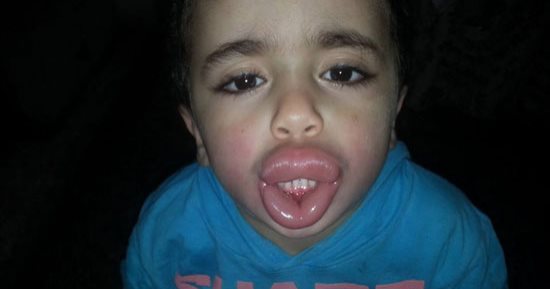 صور.. أب يحرر محضرا ضد صاحب محل بسبب تورم وجه طفله بعد تناول كيس مقرمشات