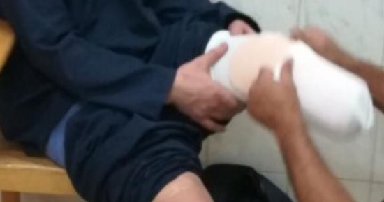 صور.. الداخلية تركب أطرافا صناعية لـ16 سجينا يعانون البتر بالأطراف