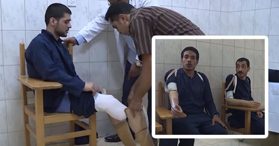 صور.. الداخلية ترسم البسمة على وجوه السجناء.. تركيب أطراف صناعية لمبتورى القدم واليد.. مصلحة السجون: خطة لاستهداف كافة النزلاء ممن يعانون البتر.. سجين: بمشى على رجلى بشكل طبيعى.. وآخر: رجعت أصافح الناس بأيدى