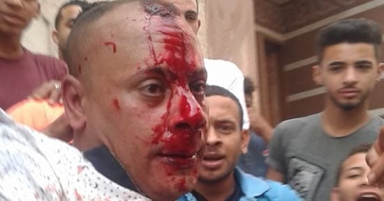صور وفيديو.. علقة ساخنة لعاطل حاول سرقة صيدلية وتعدى على عاملة بها فى المنوفية