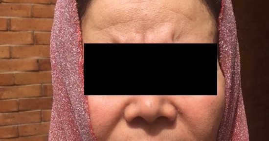 مريضة نفسية تقتل حفيدها خنقاً بكتم أنفاسه بـ"المخدة" فى المطرية  