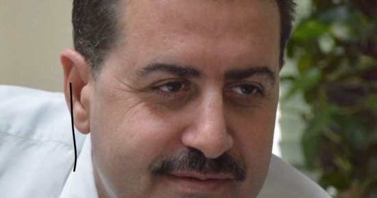 إصابة أشرف مفيد مدير إعلام صندوق تحيا مصر بكسر فى القدم