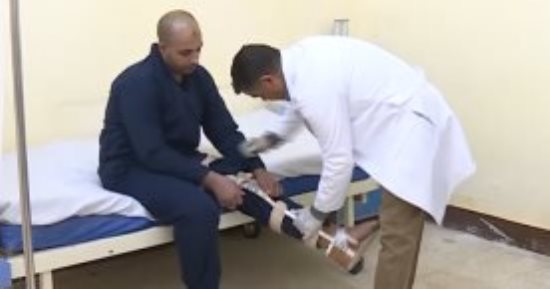 استكمال حصر حالات البتر والإعاقة بالوادى الجديد بدعمها بأطراف صناعية مجانا