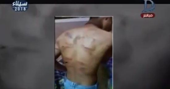 محافظ الدقهلية: نحن من اكتشفنا واقعة تعذيب الشاب بدار الأيتام وأبلغنا النيابة