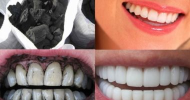 هوليود سمايل من غير تكاليف.. اعرفى إزاى تستغلى الفحم فى تبييض أسنانك