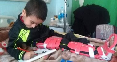 30 يوم فى الخير.. "البراء" ينتظر العلاج ويحارب تأكل العظام بابتسامته 