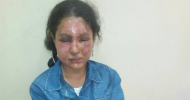 حبس 7 أشخاص بينهم خطيب وإمام بقرية بالشرقية فى واقعة إصابة مواطن وحرق طفلته