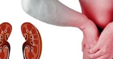 اسباب الفشل الكلوي واعراض الإصابة به 