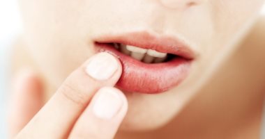 س وج .. كل ما تريد معرفته عن متلازمة الفم الحارق