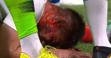 فيديو.. إصابة دموية لجيرو فى تعادل فرنسا وأمريكا 1 - 1 قبل المونديال