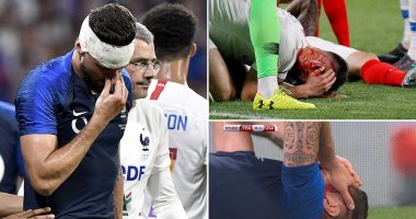 صور.. ارتجاج فى المخ و15 غرزة فى رأس جيرو قبل 4 أيام على كأس العالم