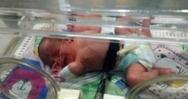 "كارما" طفلة تعانى من ثقوب بالقلب ووالدتها تطالب بعلاجها بمركز مجدى يعقوب