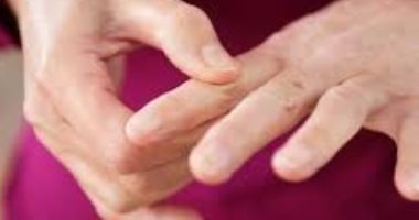 علاج الروماتيزم بالجراحة أو الراحة 