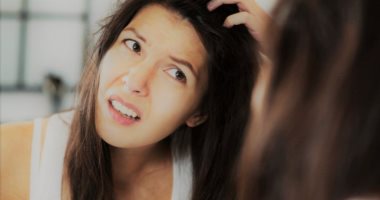 اسباب حكة الراس منها الصدفية وامراض اخرى