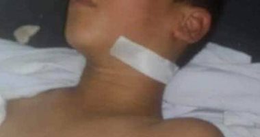 القبض على شاب بالشرقية لطعنه طفل بمنجل بعد تسلقه نخلة لحصد البلح