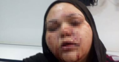 إصابة ربة منزل بطلقات خرطوش على يد شقيقها بسبب خلافات الميراث بالشرقية