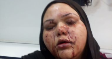 عاطل يصيب شقيقته بالخرطوش بسبب خلافات على الميراث فى الشرقية