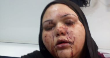حبس المتهم بإصابة شقيقته بالخرطوش لخلافات على الميراث بالشرقية