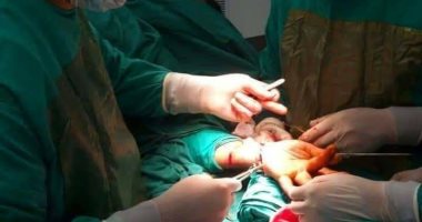 فريق طبى بمستشفى البرلس يعيد المعصم الأيمن المفصول لعامل