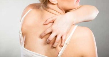 5 وصفات منزلية لعلاج حب الشباب فى الظهر