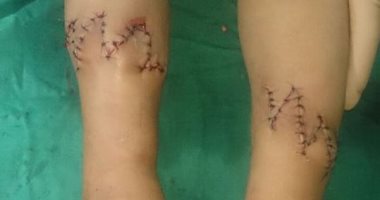 صور.. الفريق الطبي بمستشفي طور سيناء يجرى جراحة دقيقة