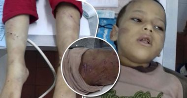 صور.. تفاصيل جريمة تعذيب طفل بإطفاء سجائر بجسده على يد والدته وخطيب شقيقته بالدقهلية.. ووالده يتهم زوجته وابنته وخطيبها بتعذيبه لمشاهدته لهم فى أوضاع مخلة.. الأمن يقبض على المتهمين.. والصحة: تم احتجازه بالرعاية