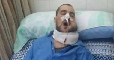 قارئ يستغيث لعلاج صديقه من ورم سرطانى بالفك السفلى