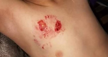 قارئ يشكو من انتشار الكلاب الضالة بأبو تيج بأسيوط وتسببها فى عقر 15 طفلاً