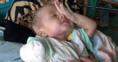 صور.. والد رضيع يتهم مستشفى قصر العينى بأسيوط بالتسبب فى بتر ذراعه اليمنى